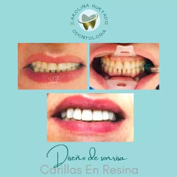 Slider image (2) Carolina Hurtado Odontologia Integral in Bogota, Colombia